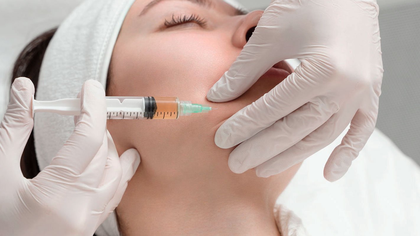 APLICAÇÃO_BIOESTIMULADOR_DE_COLAGENO2